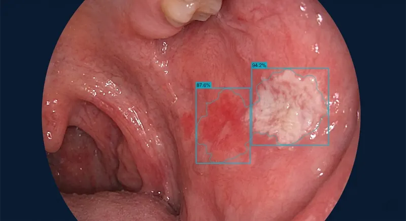 Procen-Mucosa — 口腔黏膜分析